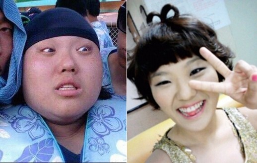비포에프터 이미지