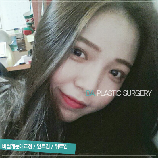 이미지성형외과 이미지