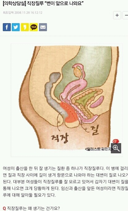 개충격... 출산시 감당해야할 리스크 중에 이런게 있다는거 알아? | 인스티즈