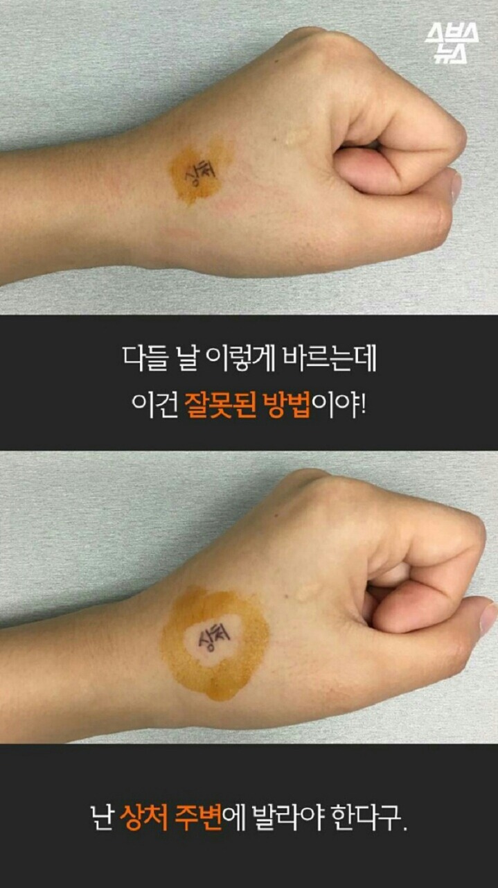 빨간약의 허위 기사~ | 인스티즈