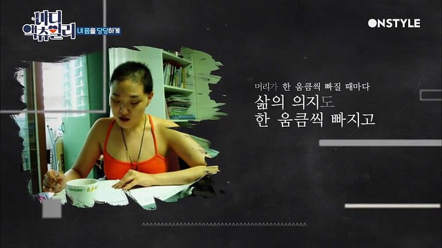 전신탈모증 윤사비나씨가 생각하는 아름다움.jpg | 인스티즈