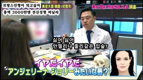프랑스 인형이 되고싶어 총액 3000만엔 전신성형한 바닐라 | 인스티즈